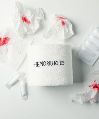 Are Bidet Good for Hemorrhoids?